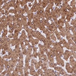 TMPRSS7 Antibody, Novus Biologicals:Antibodies:Primary Antibodies